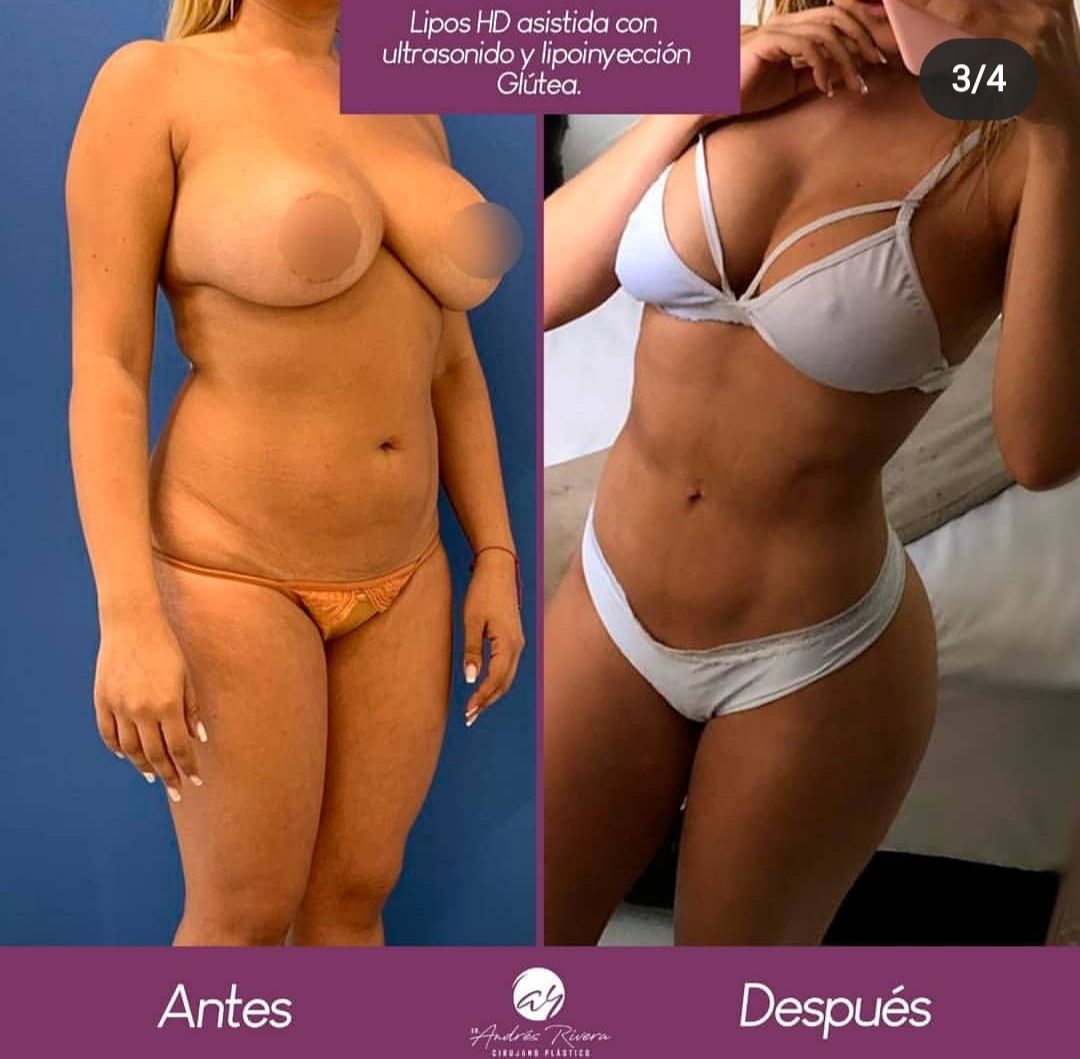 Andrés Rivera López-15