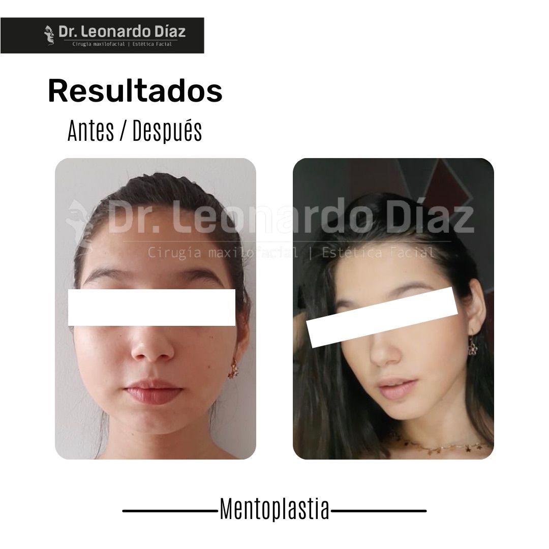 Leonardo Diaz Martínez-11