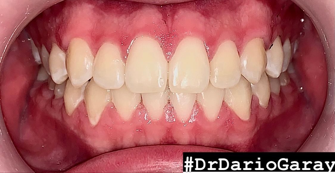 Dario Antonio Garay Chaustre-7