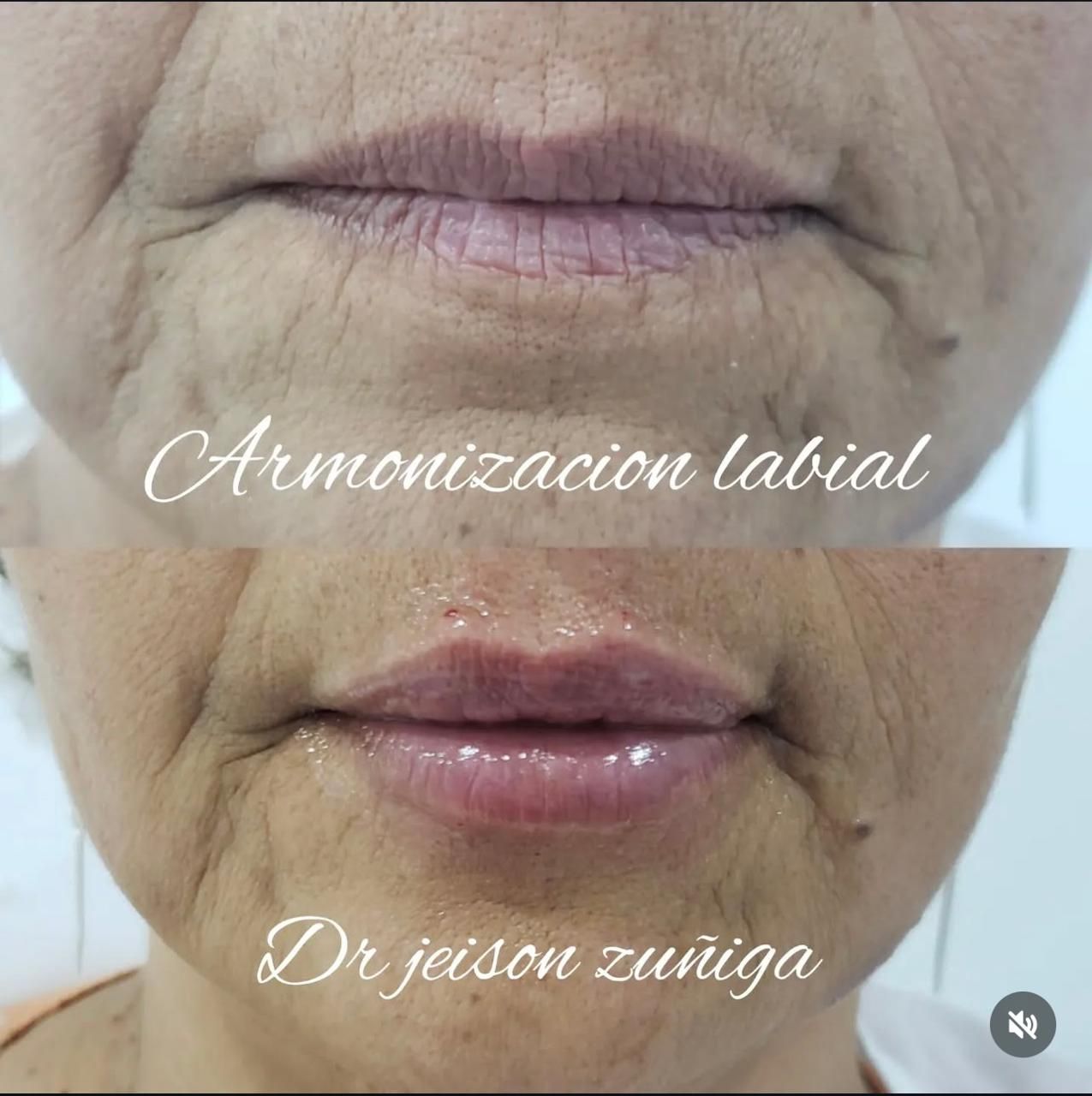 Jeison De Jesus Zuñiga Lara-5