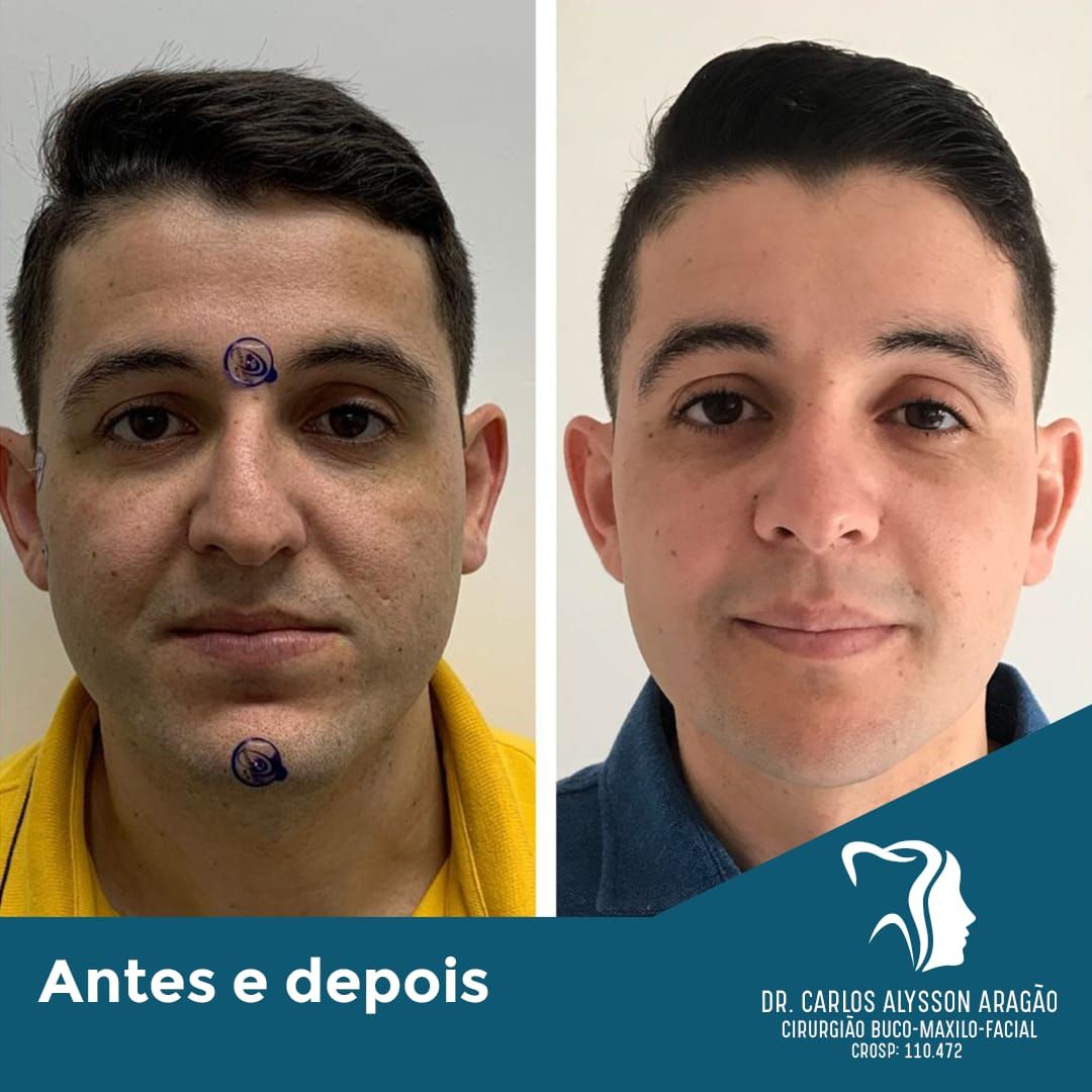 Carlos Alysson Aragão-17