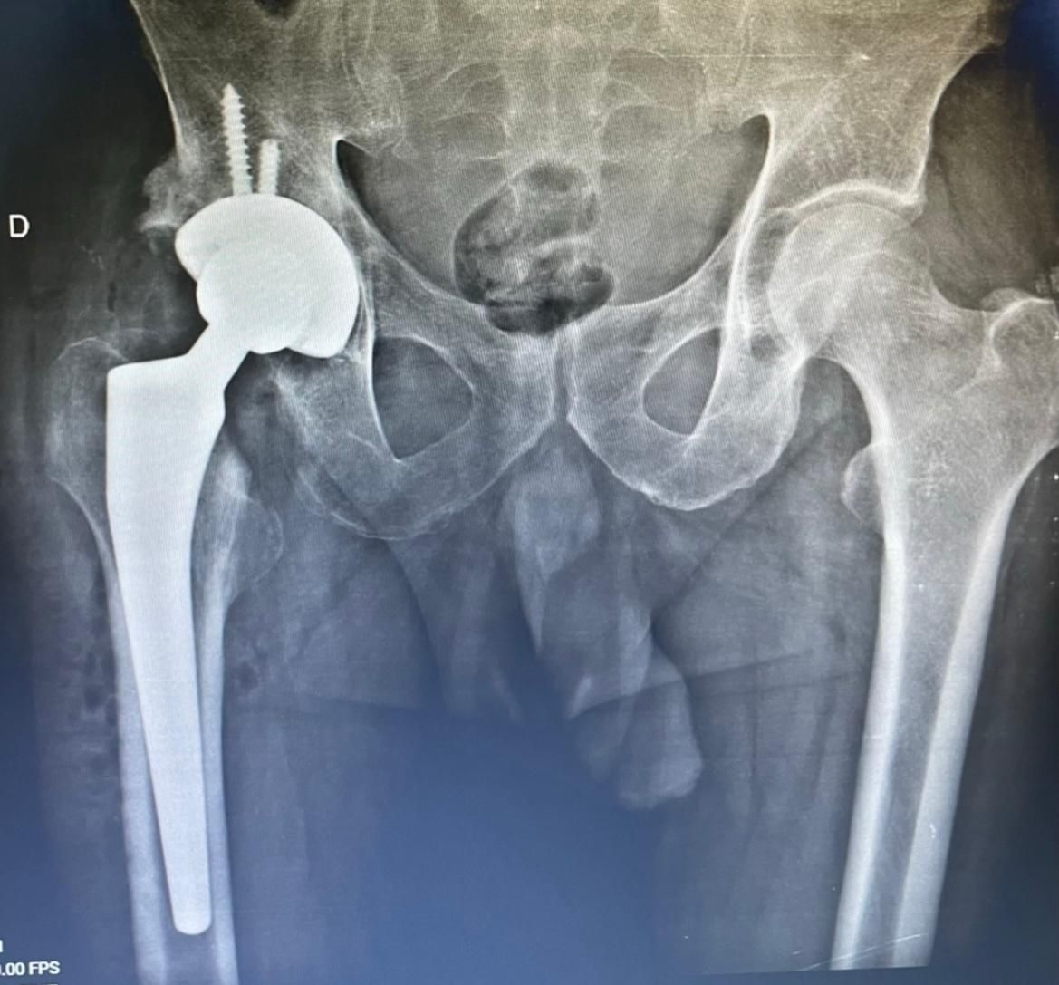 Jônatas Laurindo Giacomini-27