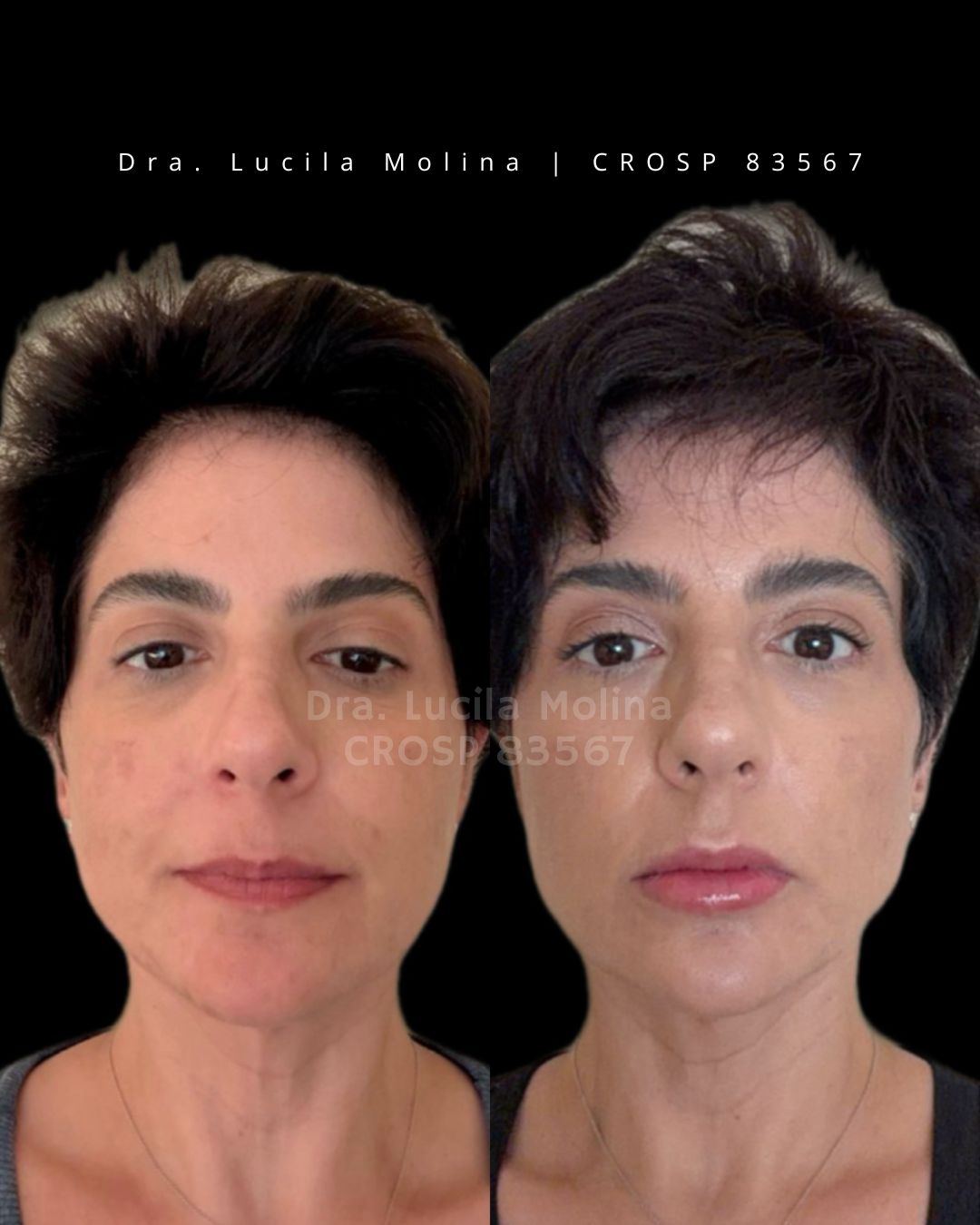 Lucila Molina-1