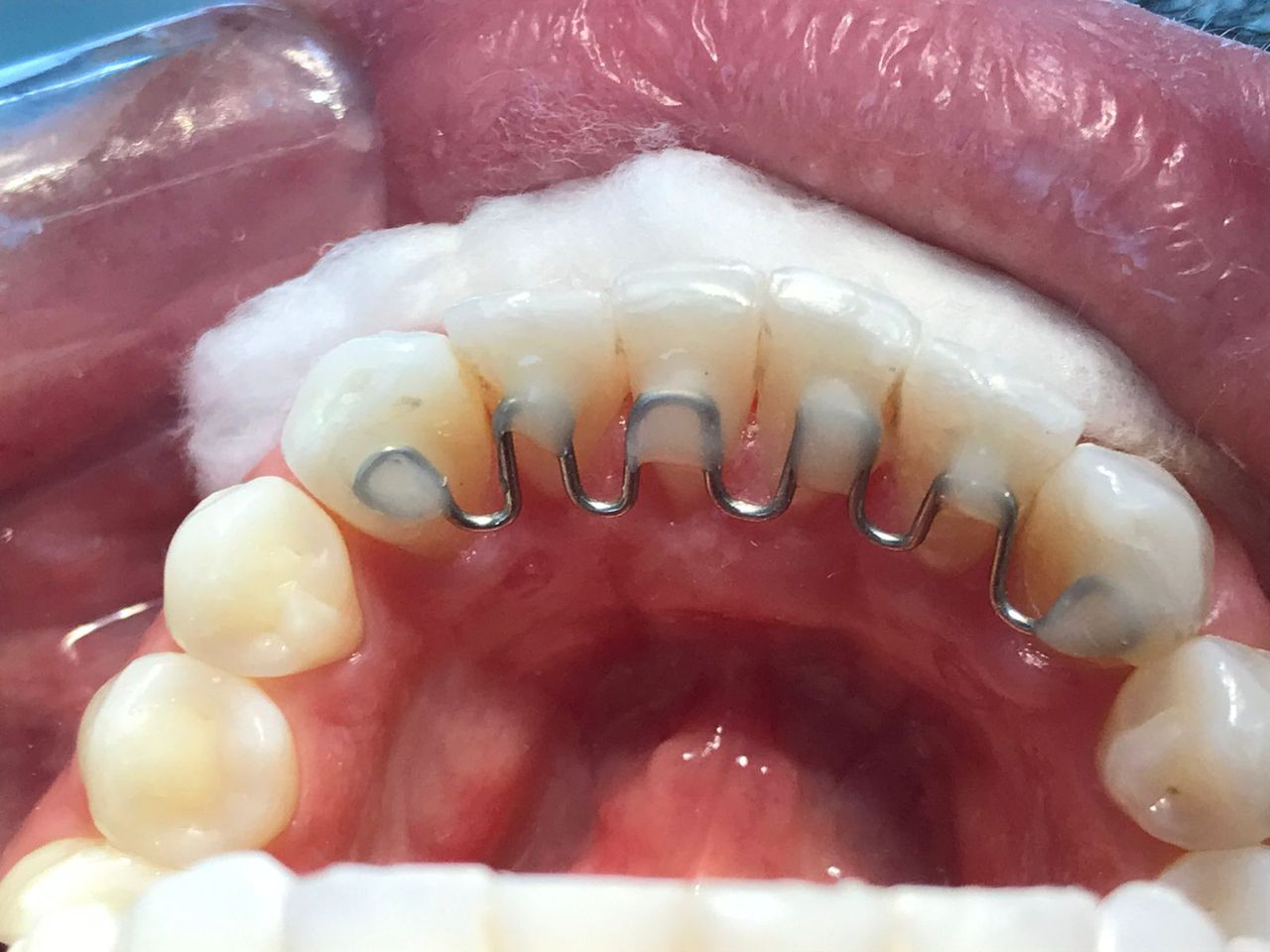 Francisco De Assis Almeida Lima Júnior-17