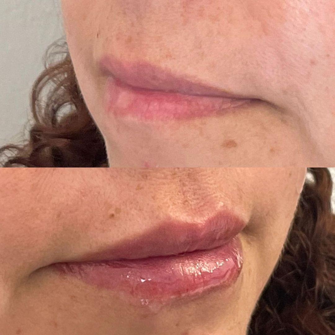 Scarlett Bartsch Ferrada-37