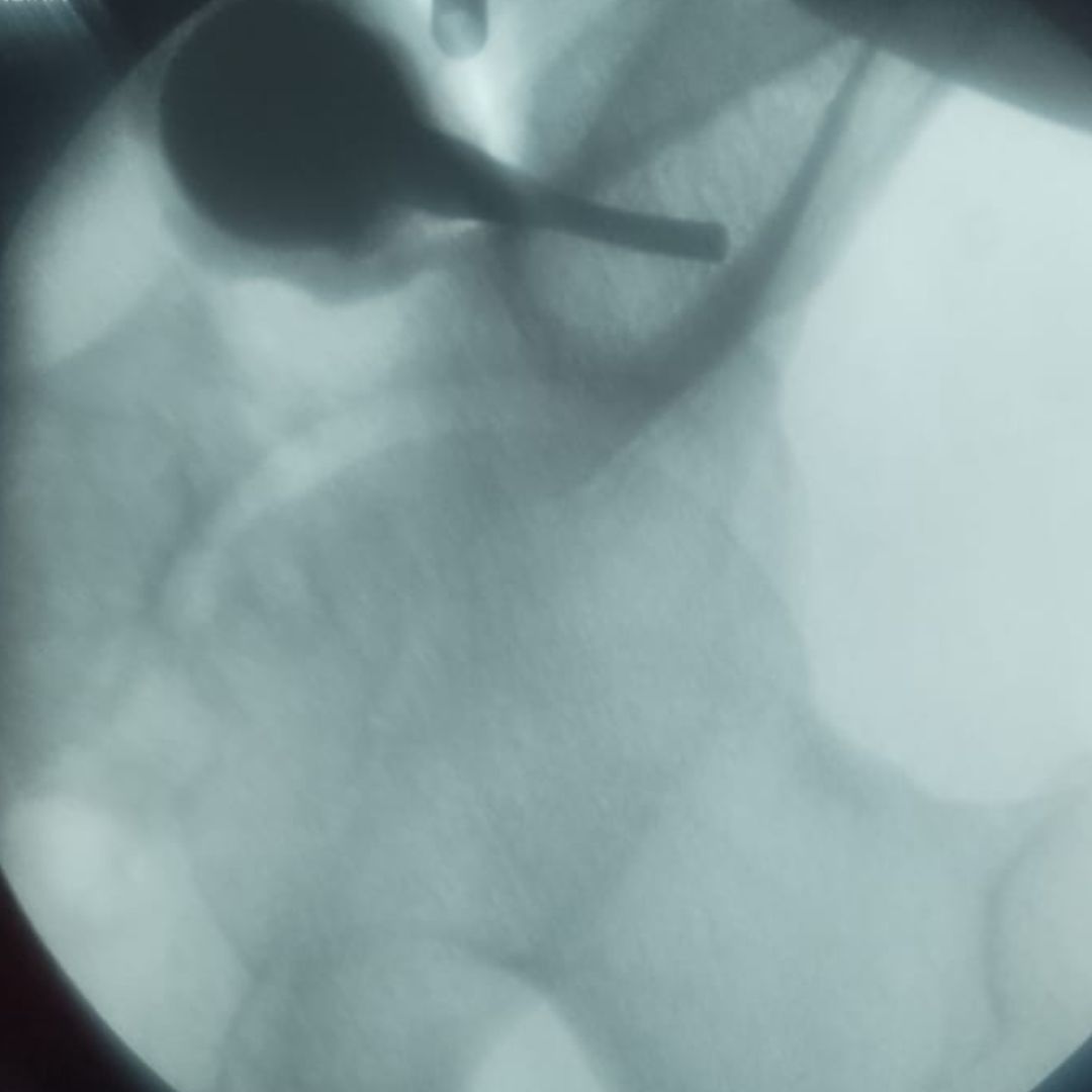 David Tafur Muñoz-2330