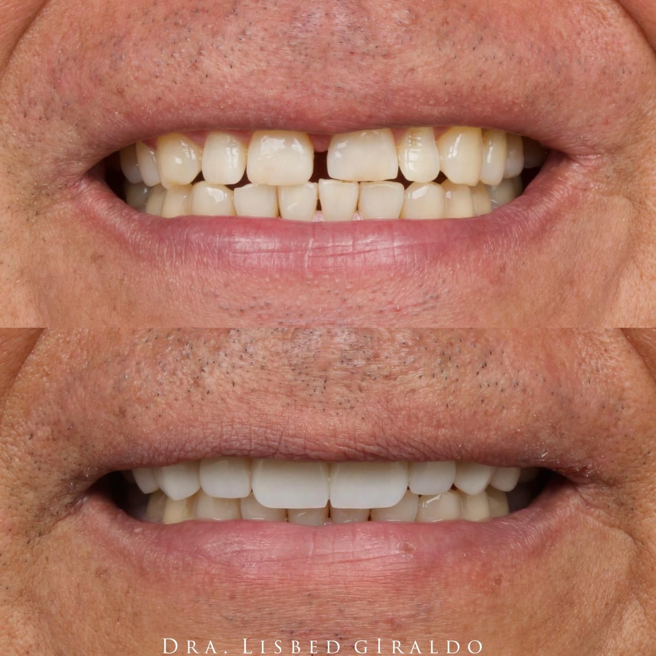 Lisbed Giraldo Olarte-5