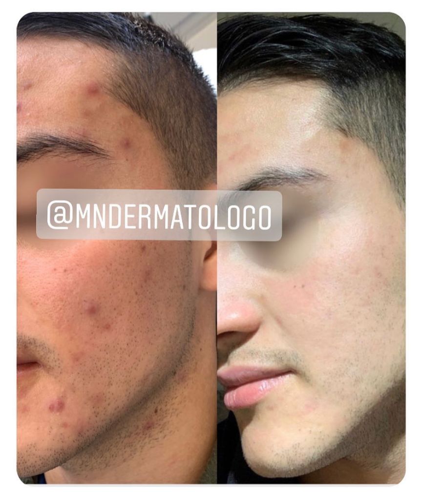 Mario Naranjo Otero-5