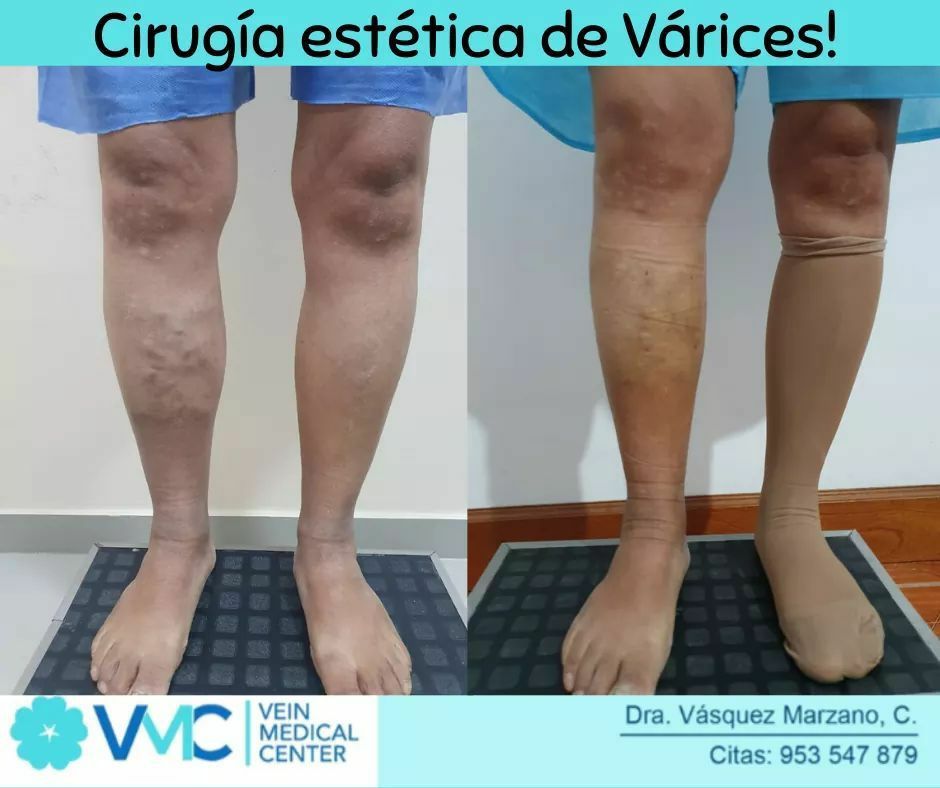 Cindy Vásquez Marzano-10