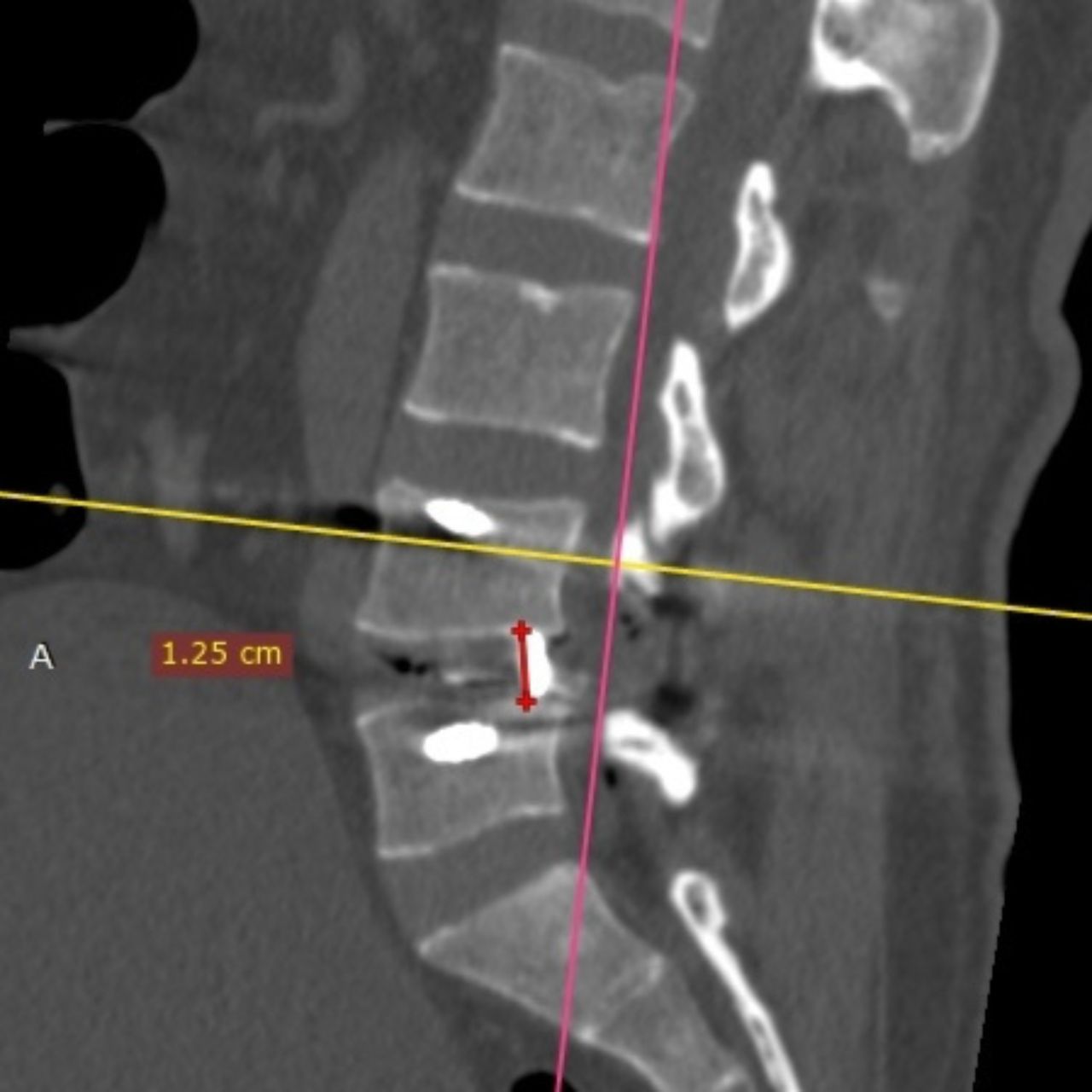 David Tafur Muñoz-1531