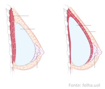 Mariana Fernandes Zalli-13