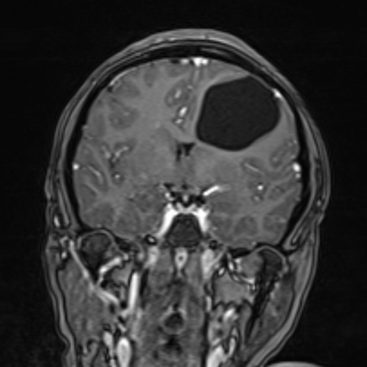 David Tafur Muñoz-1815