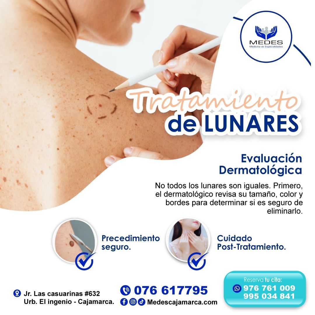 Edgar Alvarez Llanos-1