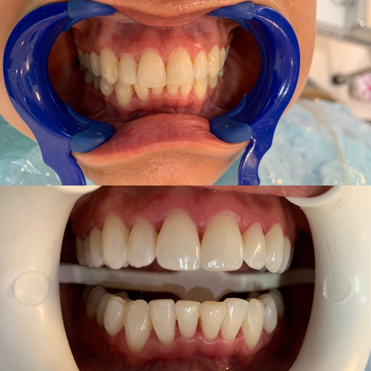 Isail Klahr Averbuch-7