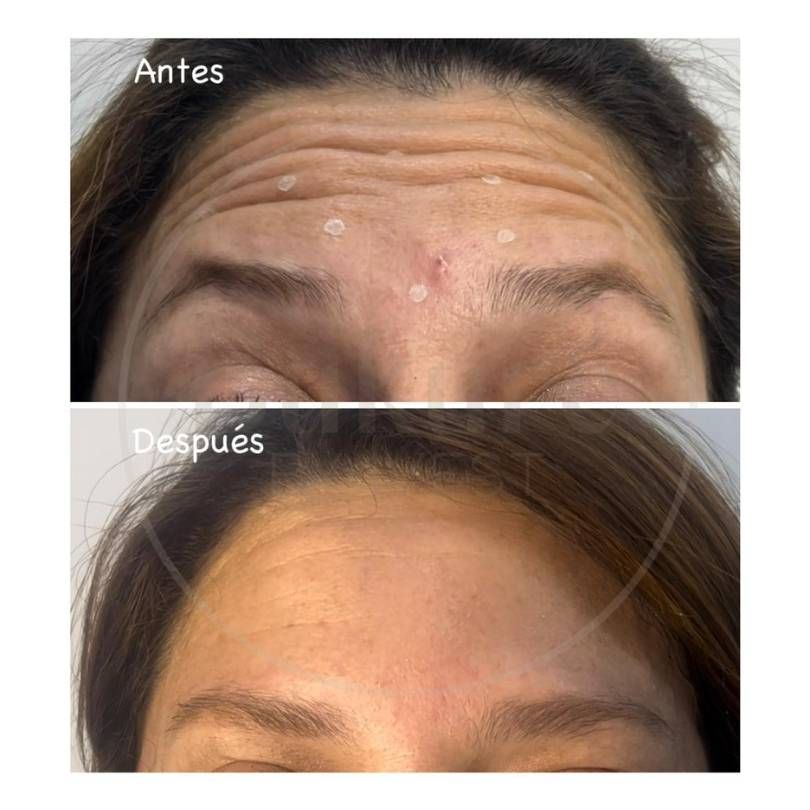 Oscar Iván Lozano Navarrete-15