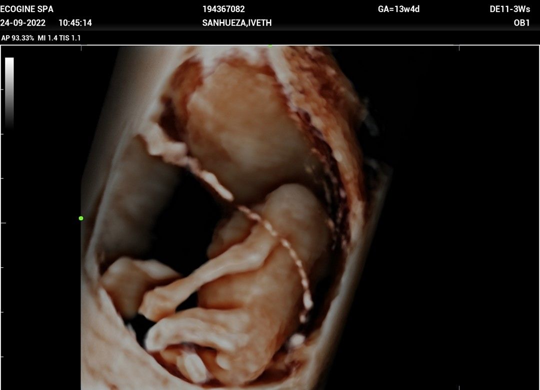 Marcelo Fierro Jarrin-16