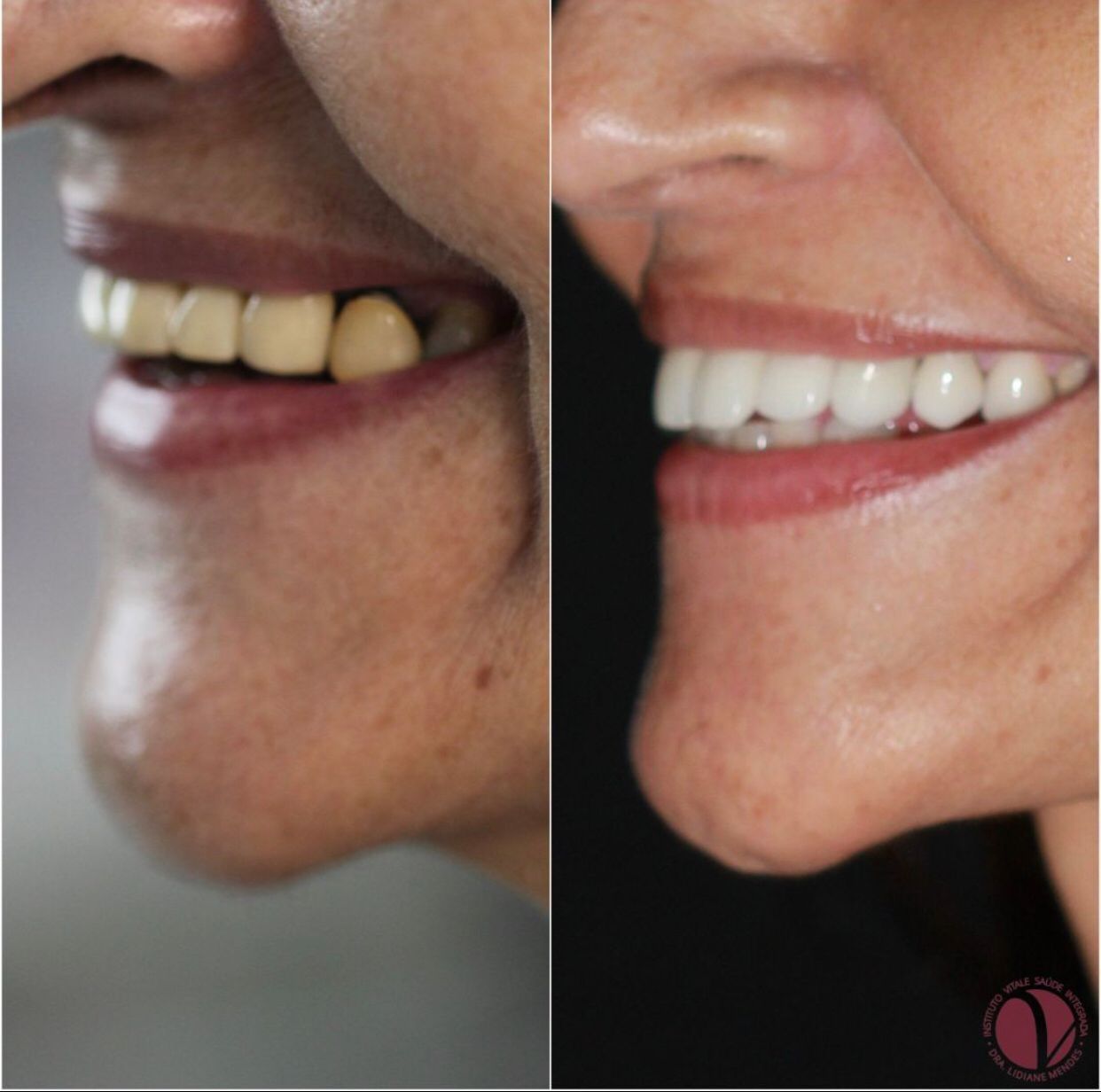 Lidiane Morais Mendes-25