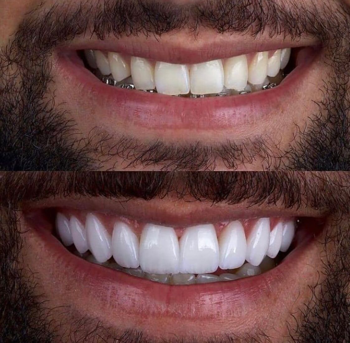 Ivanilda Martins Da Silva-8