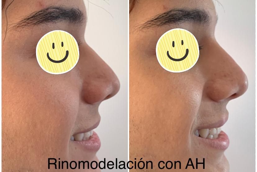 Maria Gisela Angel Losada-40