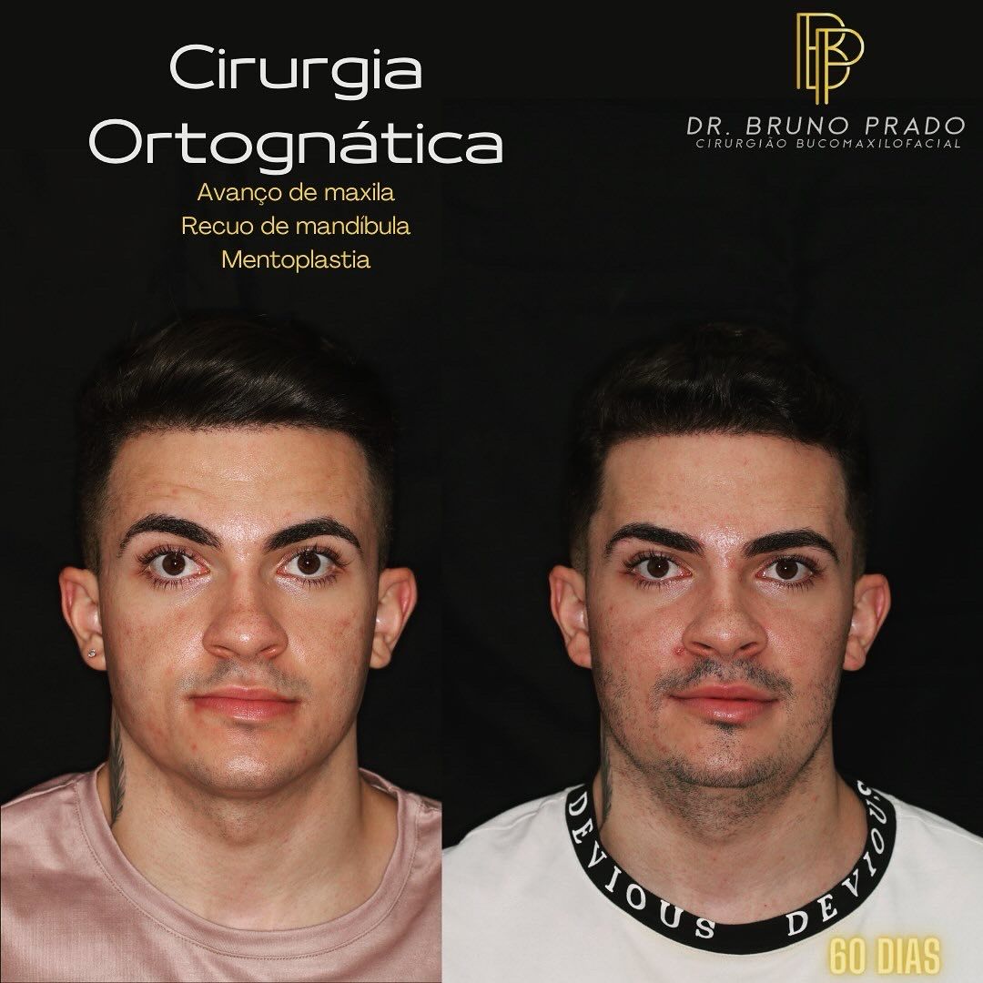 Bruno Nifossi Prado-33