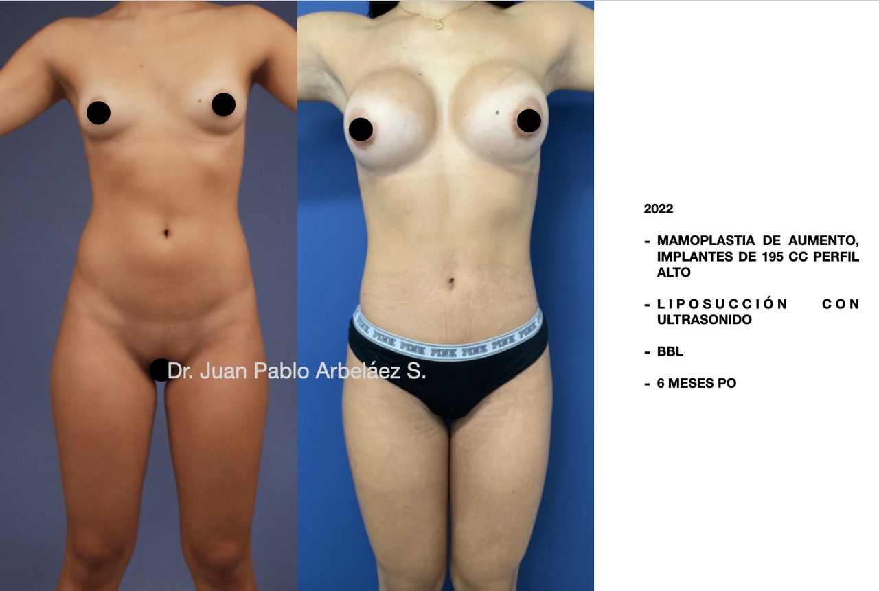 Juan Pablo Arbeláez Sierra-34