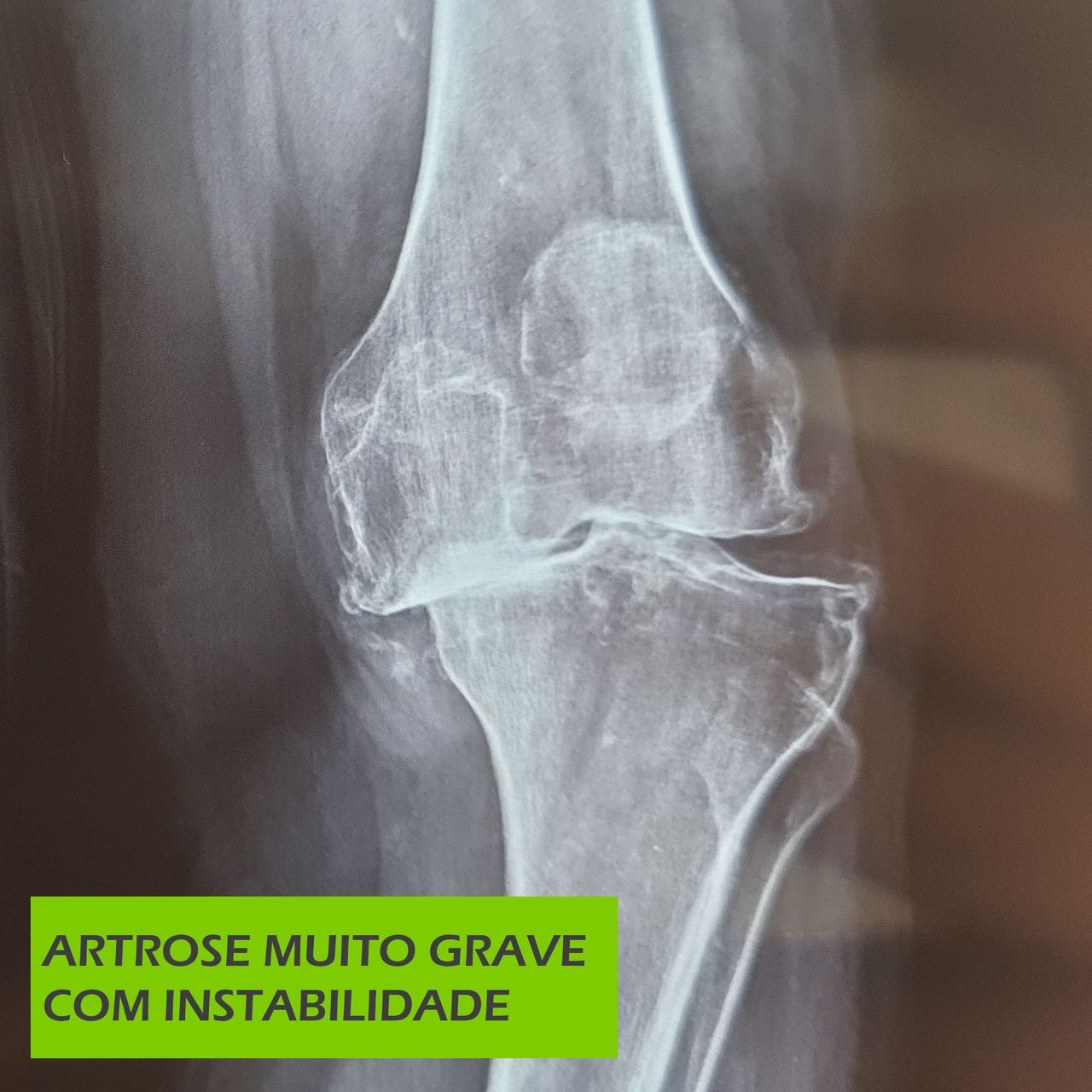 Paulo Roberto Capelletti-37