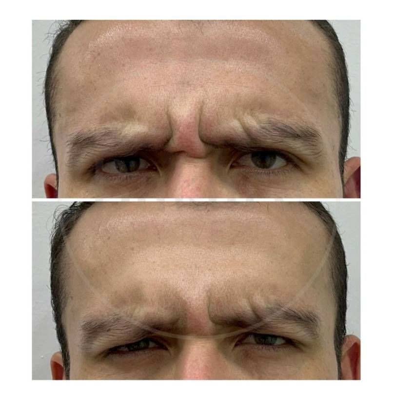 Oscar Iván Lozano Navarrete-7