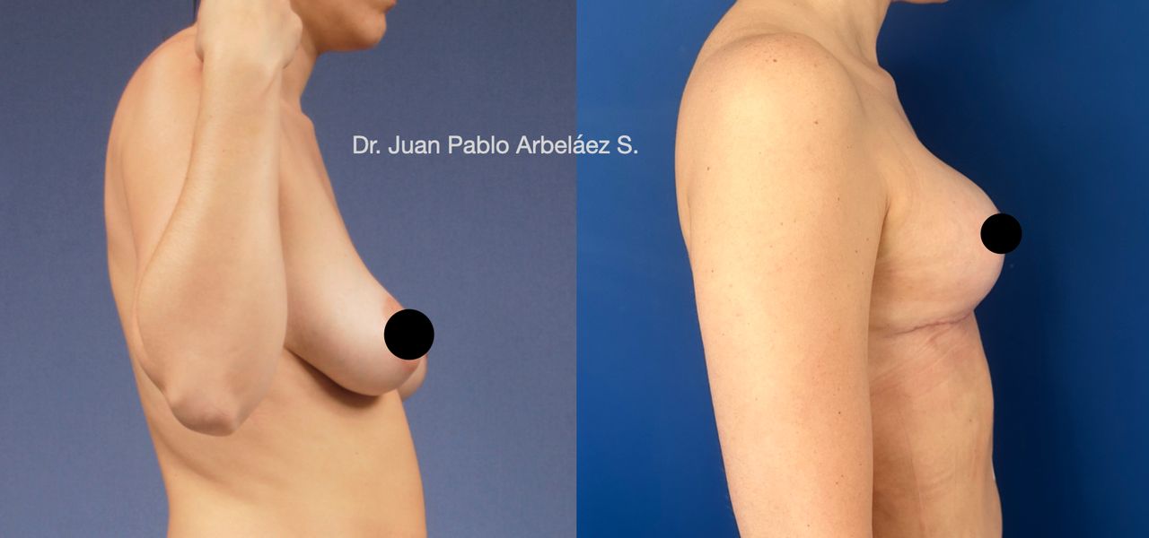 Juan Pablo Arbeláez Sierra-6