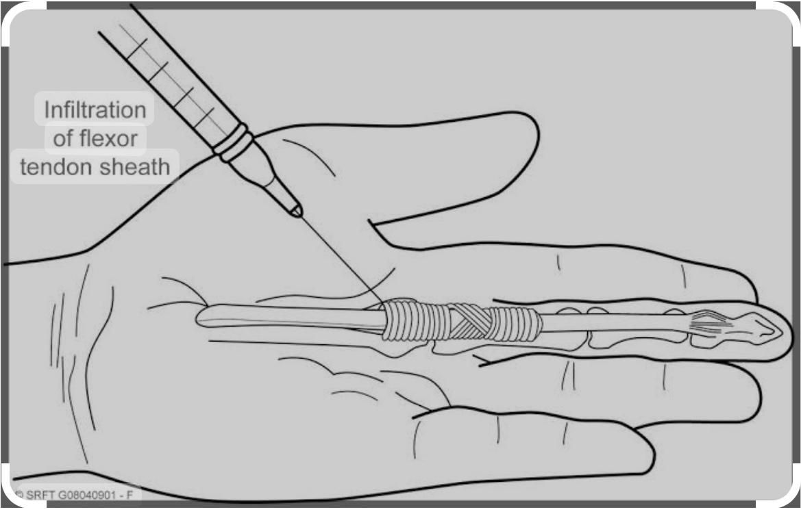 Jônatas Laurindo Giacomini-32