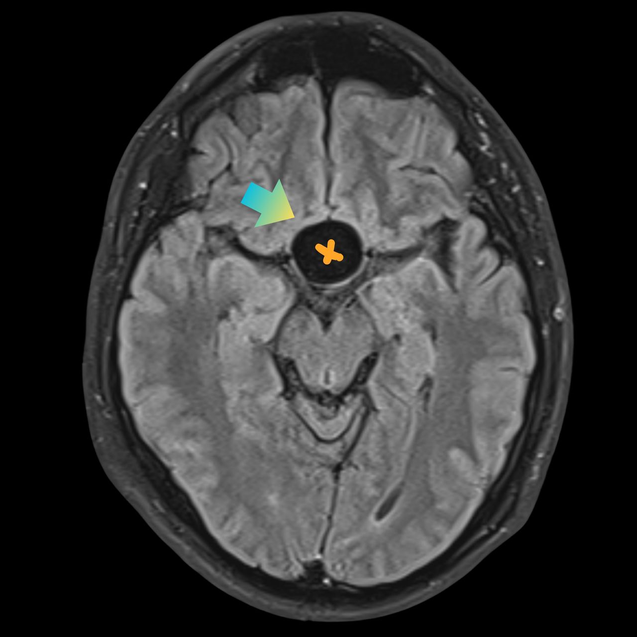 David Tafur Muñoz-2613