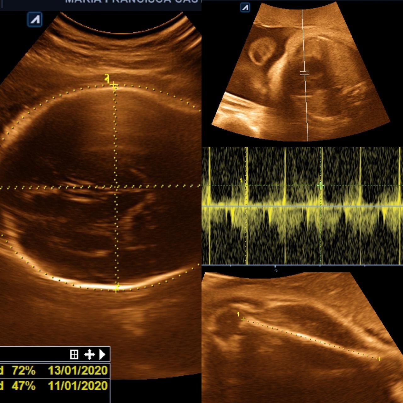 Benjamín Villarroel Castillo-17