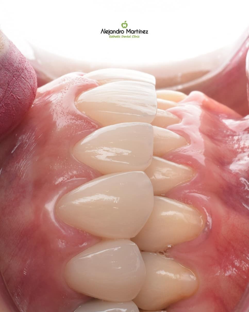 Alejandro Martinez-9