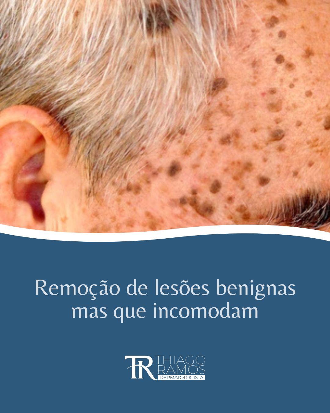 Thiago Ramos-5