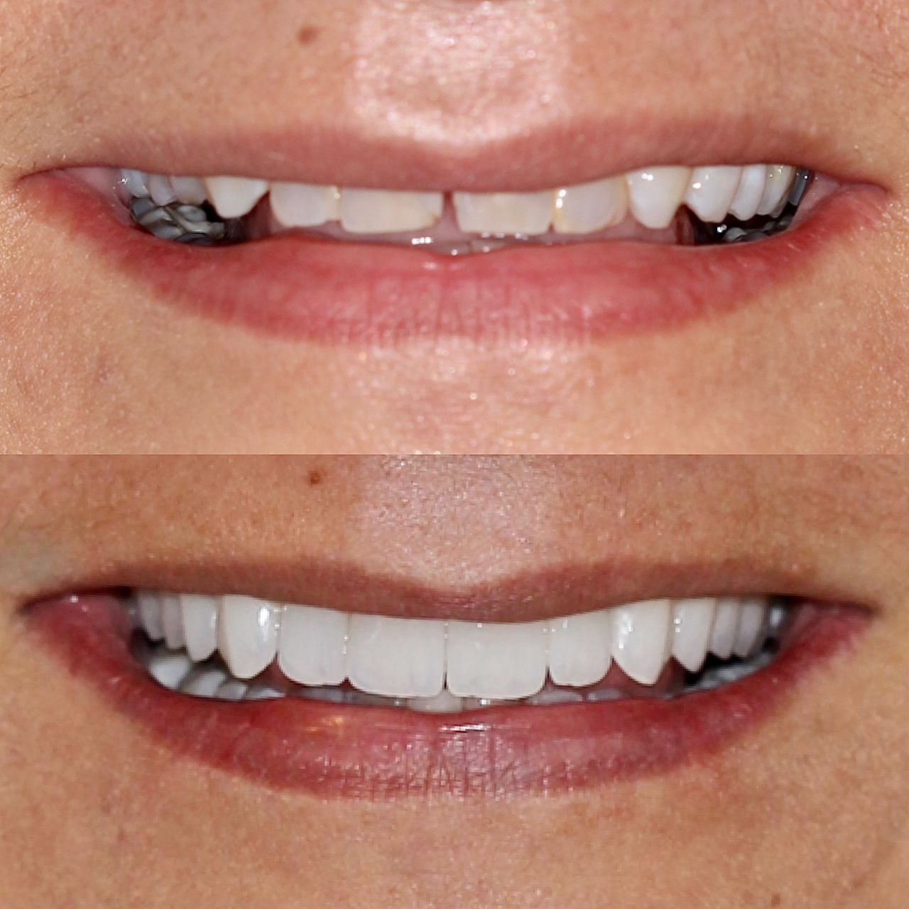 Caroline Benedeti-22