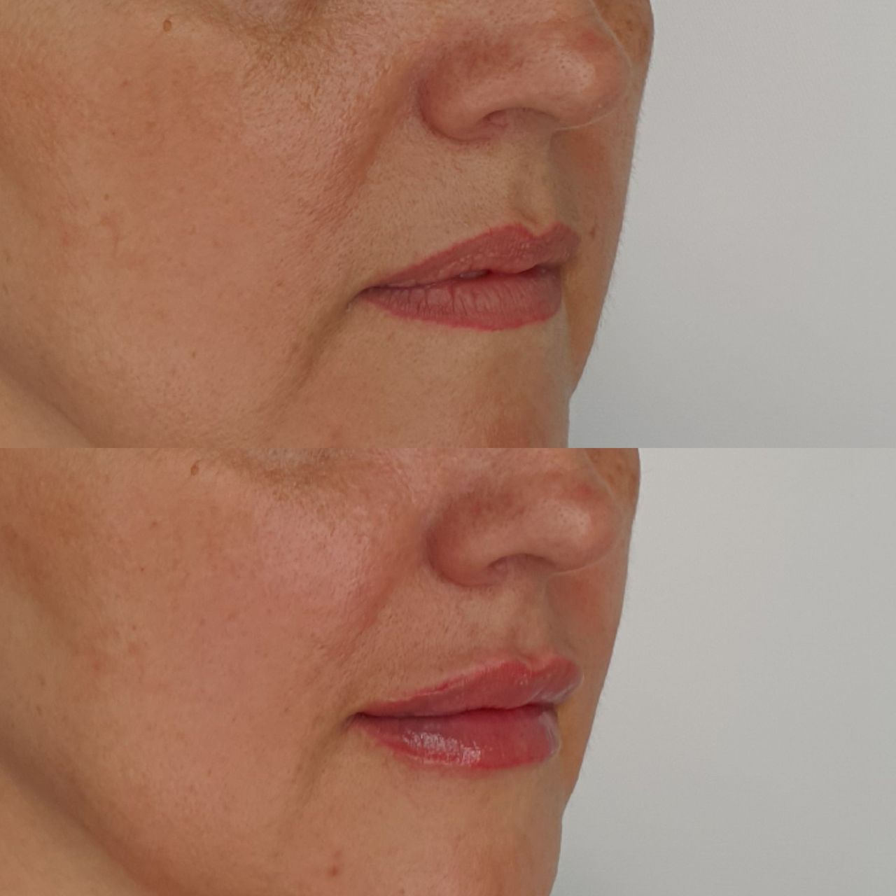 Juan Guillermo Bretón Franco-26