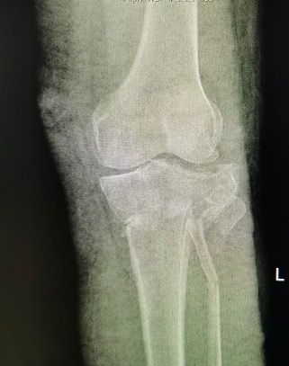 David Cabrera Ortiz-3