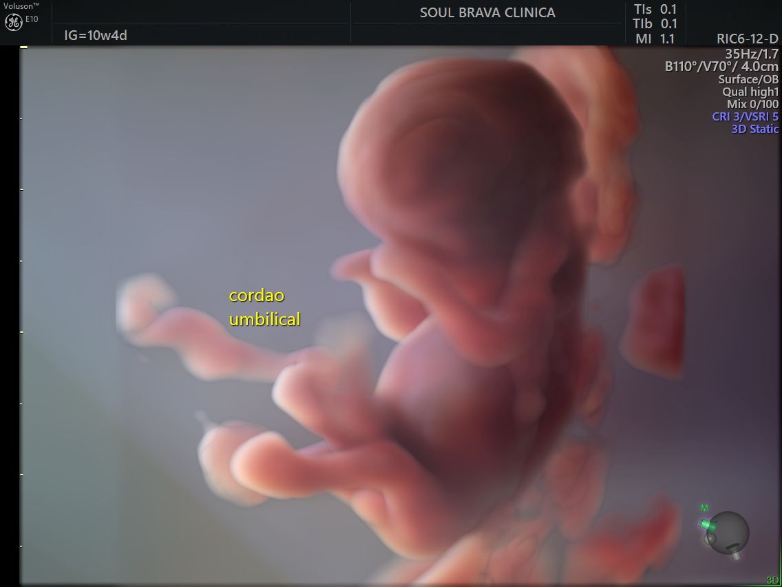 Charles Schwantz De Lima-23