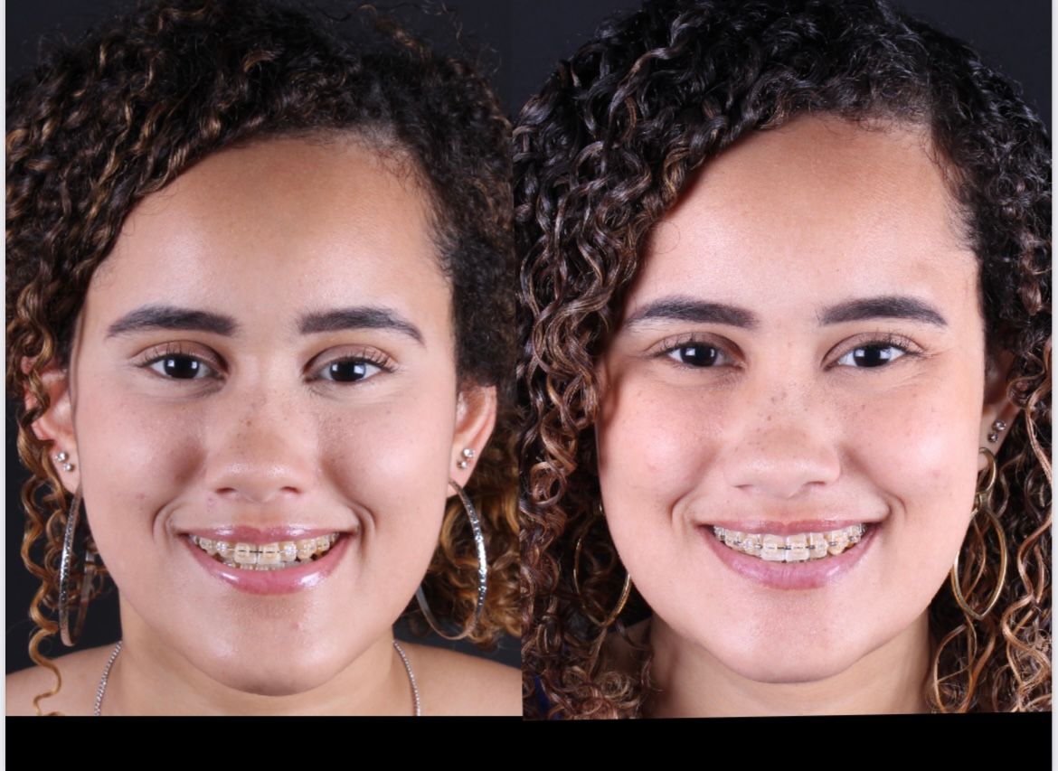 Frederico Carnevale-0