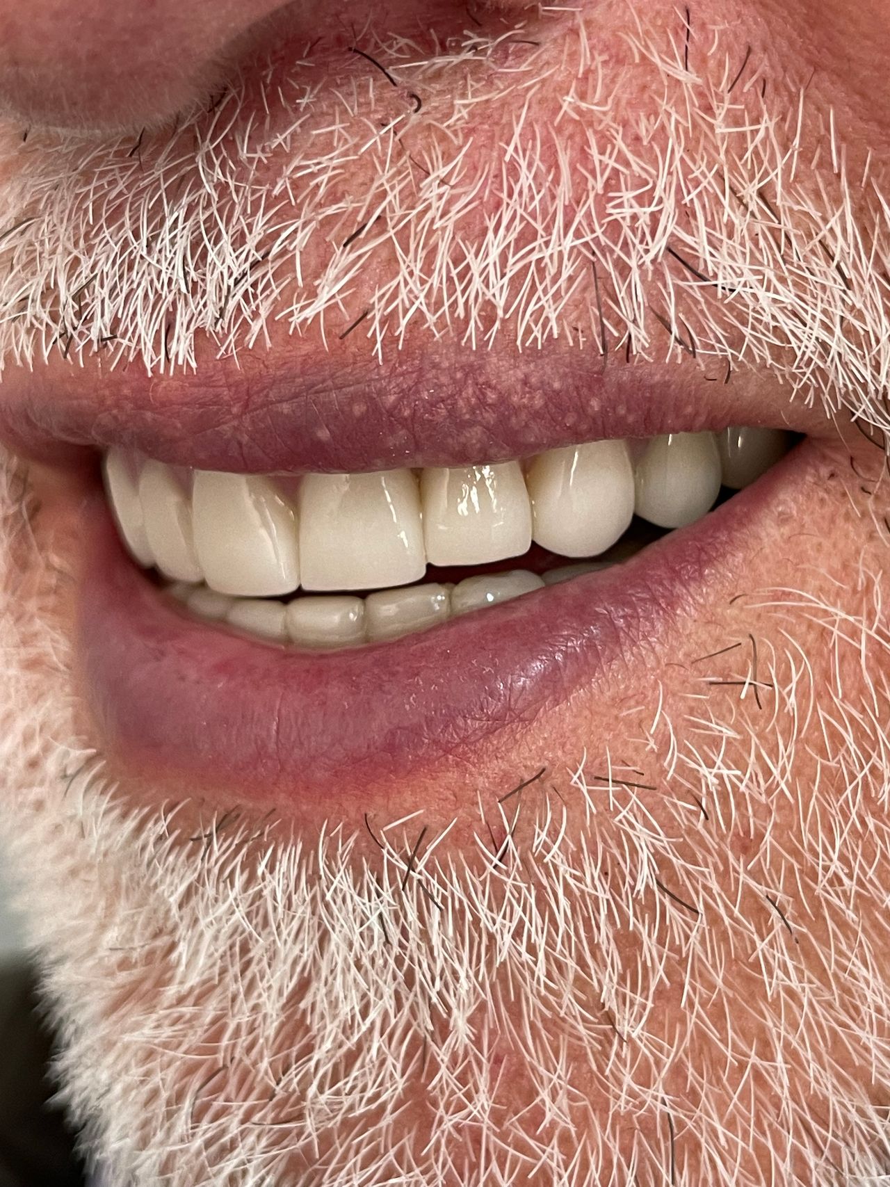 Luciano Varas Salinas-44