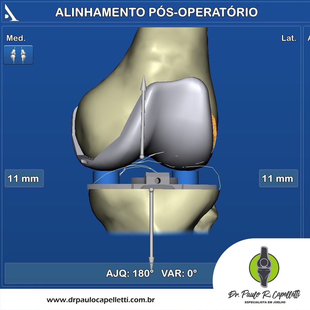 Paulo Roberto Capelletti-76