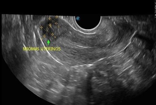 Arisev Maria Figueroa Ramos-5