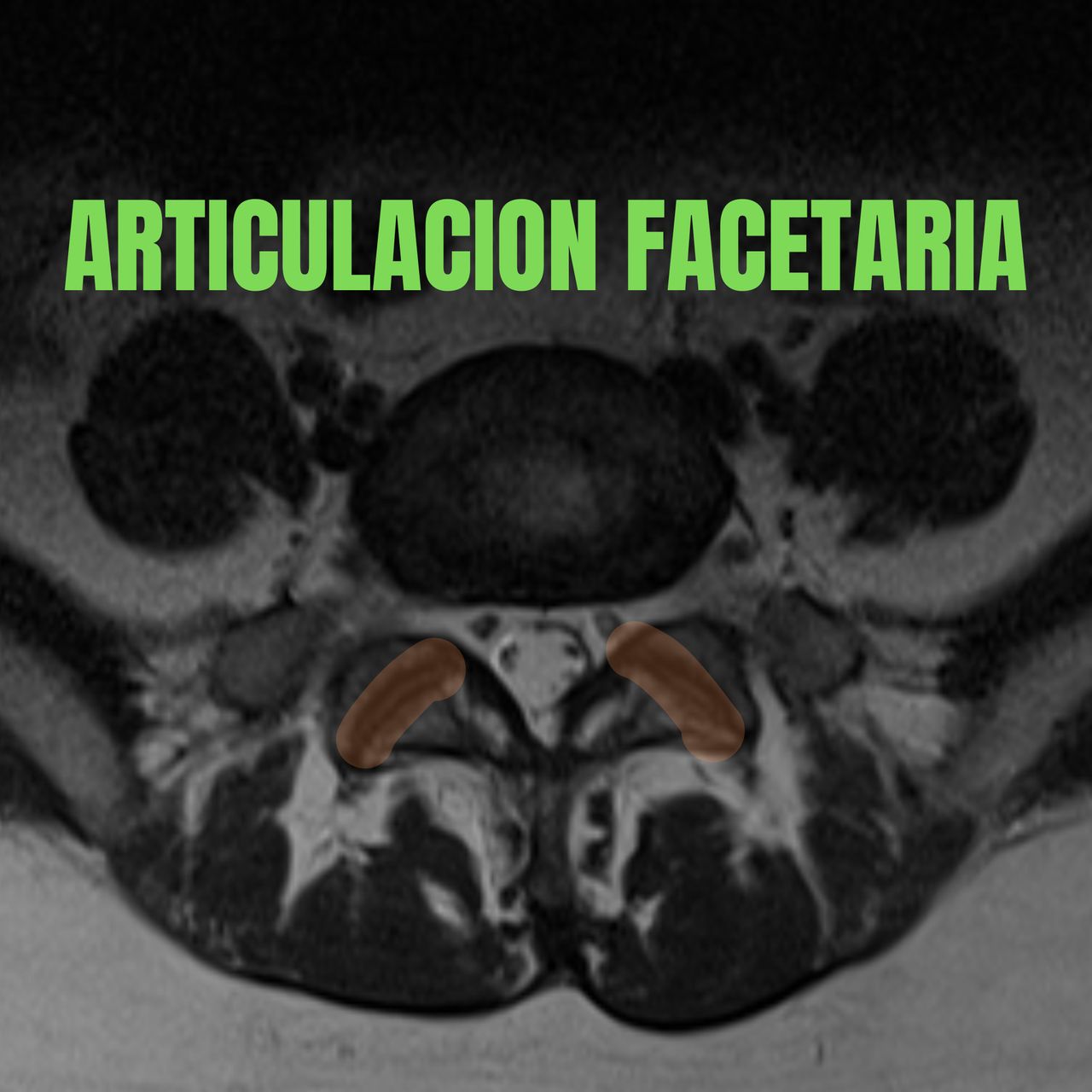 David Tafur Muñoz-2228