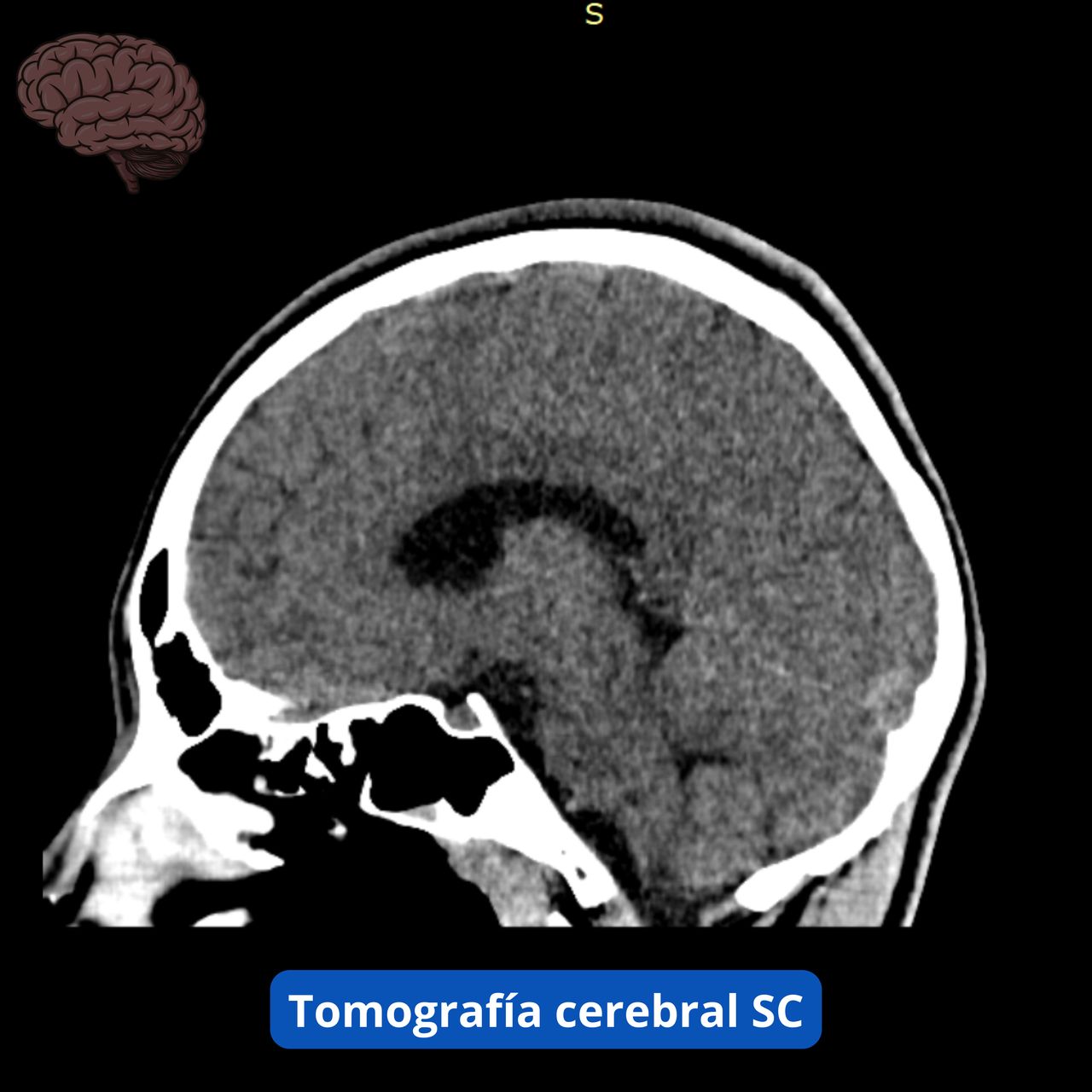 David Tafur Muñoz-1880