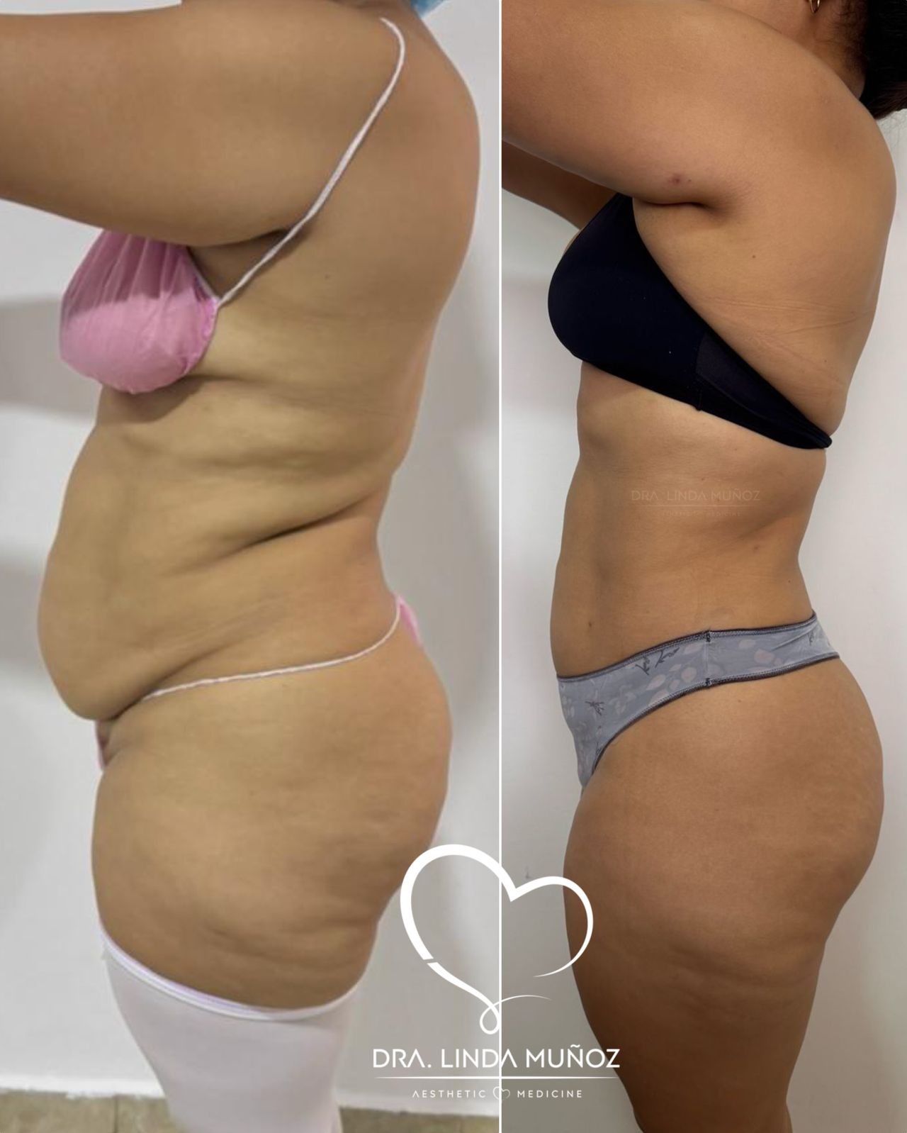 Linda Muñoz-47