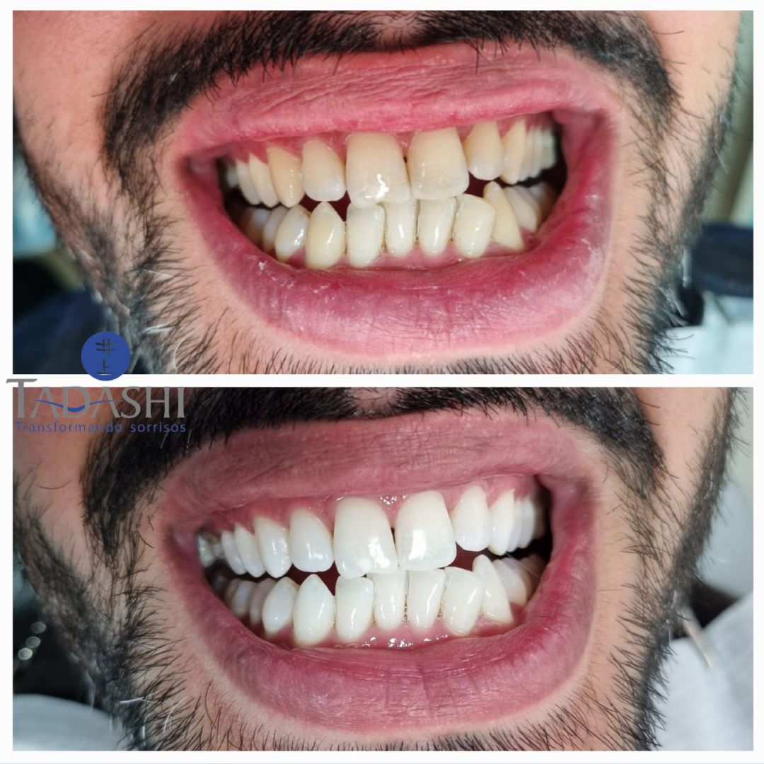 Daniele  Sunto Spinola-4