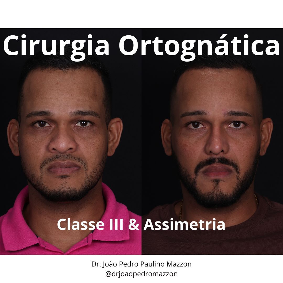 João Pedro Paulino Mazzon-54