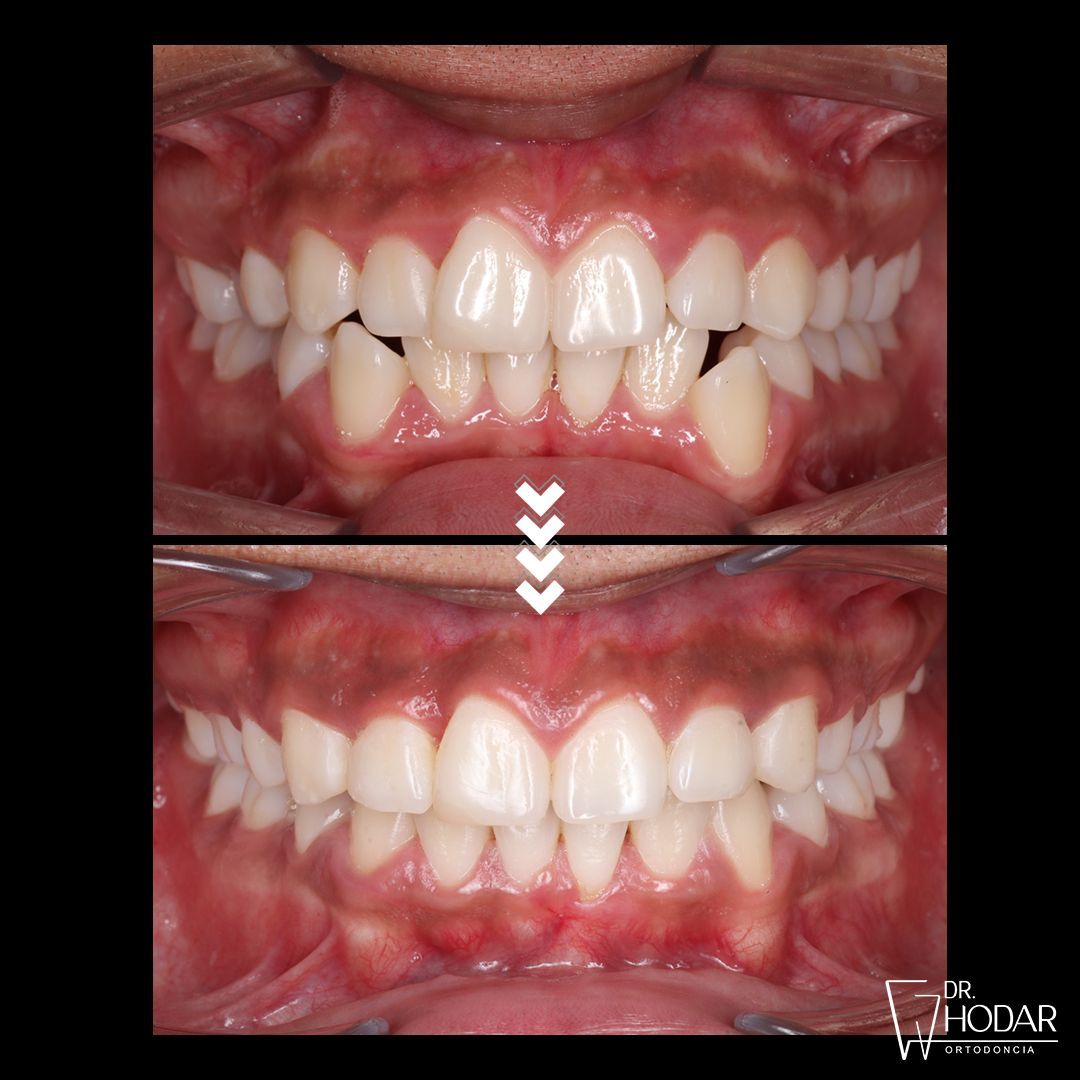 Rodrigo Hodar Dinamarca-5