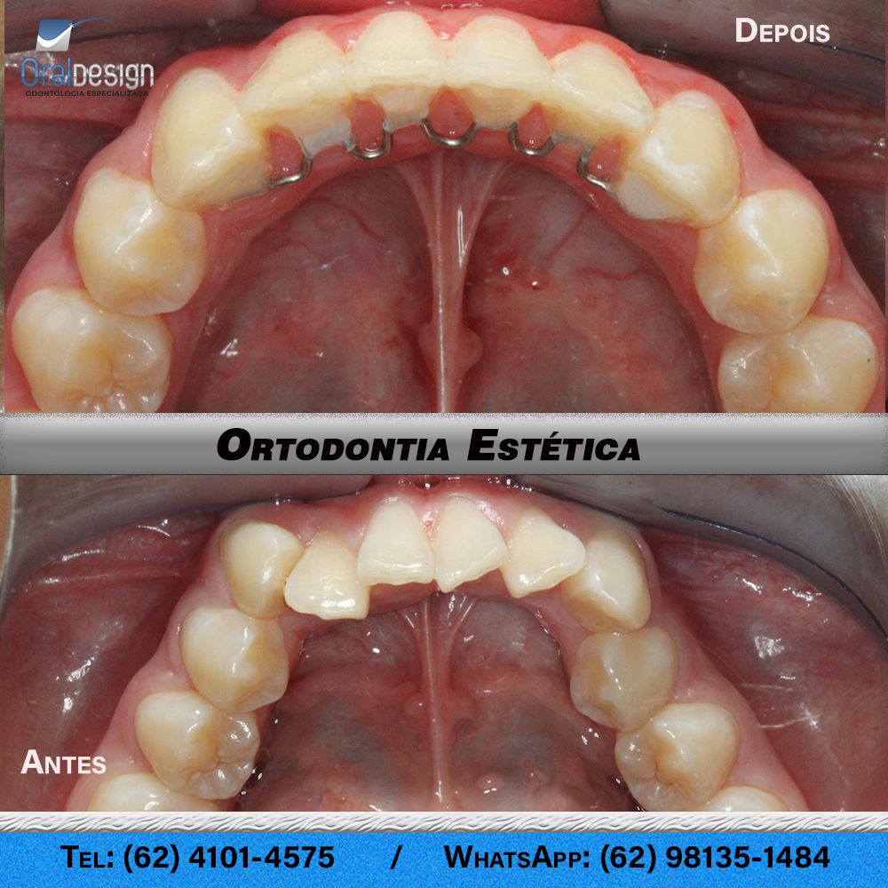 Danilo Monteiro Rezende Pereira-15