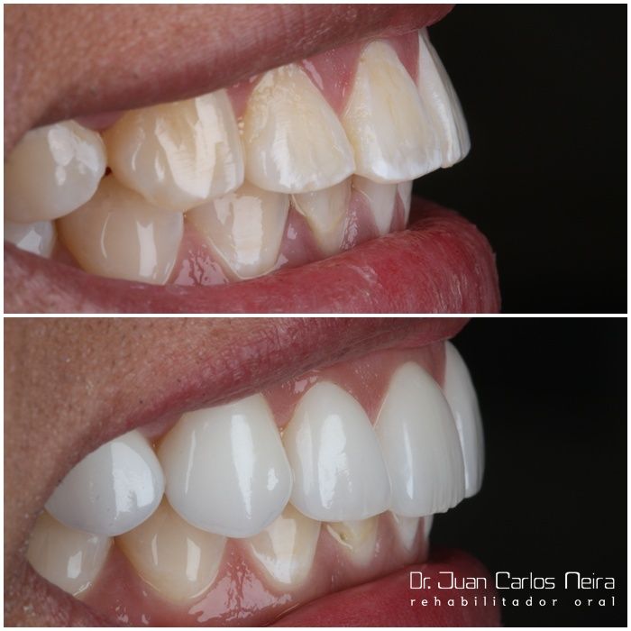 Juan Carlos Neira Rueda-17