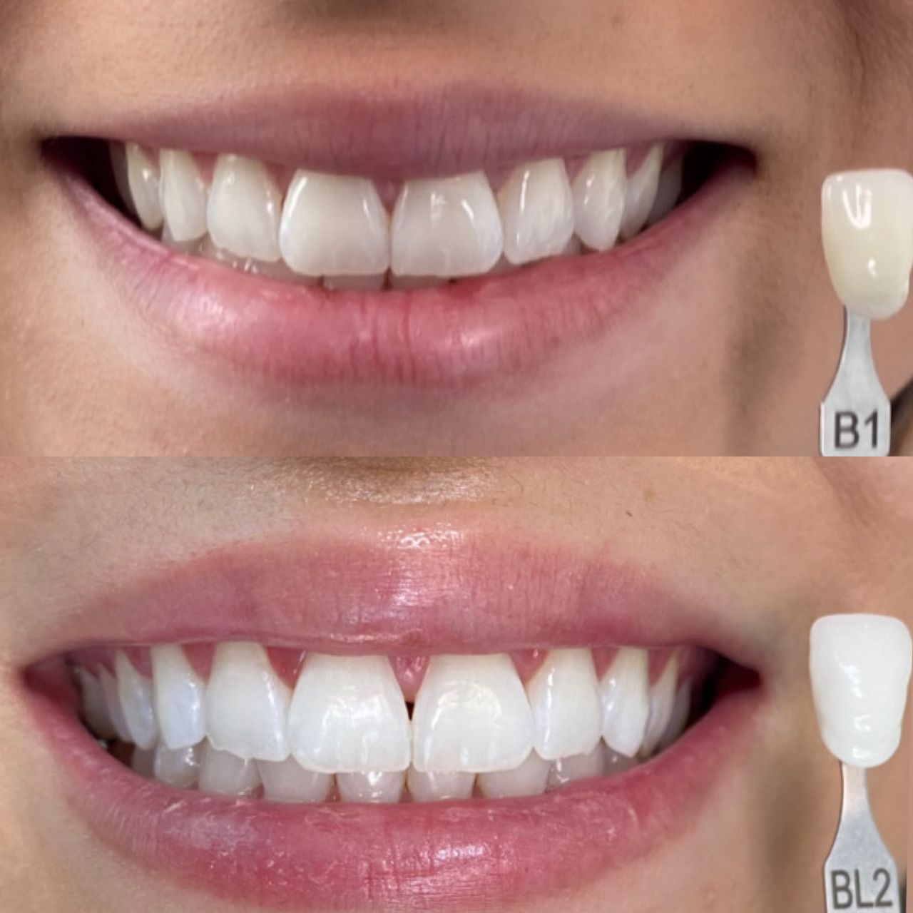 Caroline Benedeti-30